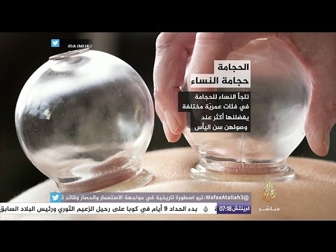 ما الحجامة؟ وما أنواعها؟ وما فوائدها للنساء خاصة؟