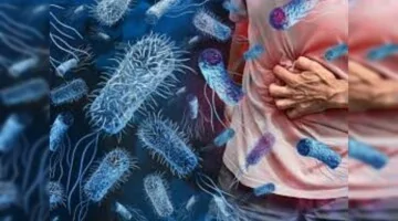 ما حقيقة ظهور مرض الكوليرا في أسوان؟ .. وزارة الصحة تحسم الجدل