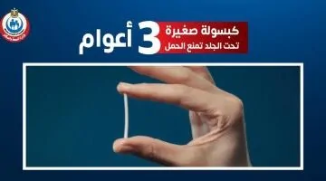 هل الكبسولة وسيلة منع حمل آمنة حقاً؟ استشاري نساء يكشف التفاصيل